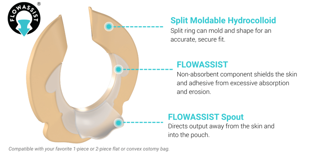 Image of flowassist seal with arrows pointing at key features. FLOWASSIST protects the adhesive while FLOWASSIST Spout directs stoma output. Compatible with your favorite pouching system.